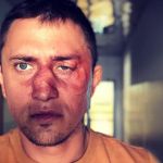 Друг Прилучного рассказал подробности избиения артиста