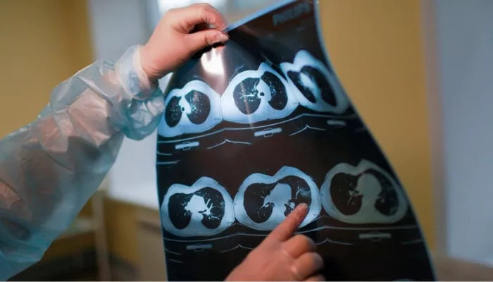 В больницах края избыточно много техники для диагностики, заявил глава минздрава