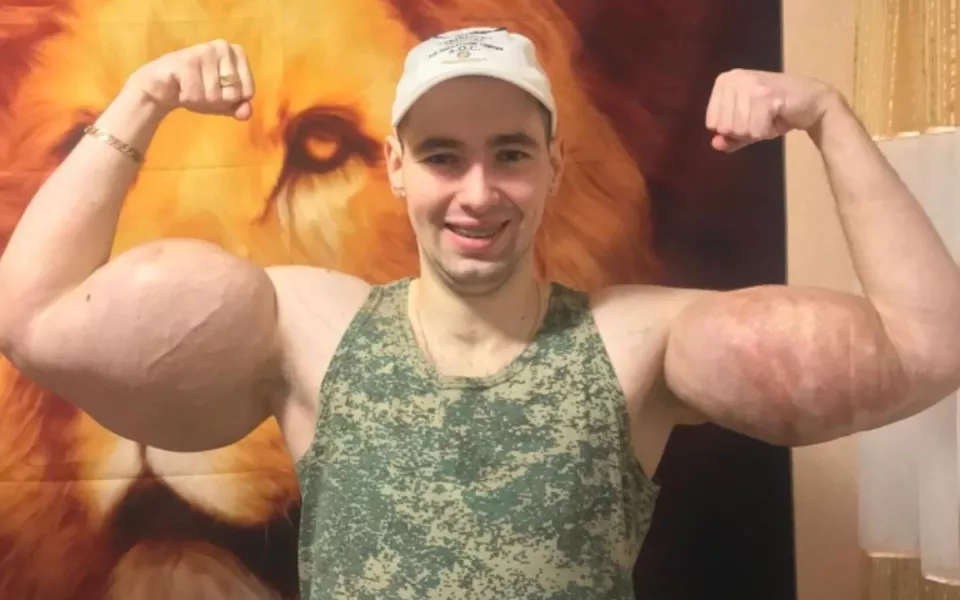 Не могут стабилизировать: Рукам-базукам грозит ампутация рук