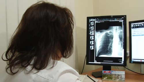 Туберкулез: алтайский медик рассказала о правде, мифах и дорогостоящем лечении