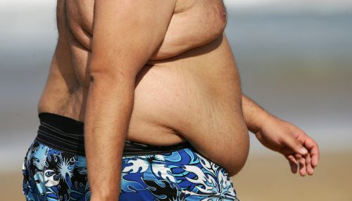 Мясников рассказал, где живет самый опасный для человека жир