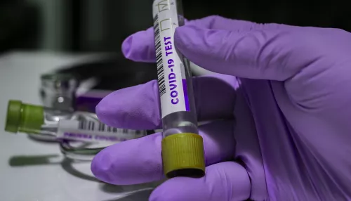 Российские вирусологи собрали конструкцию вакцины против штамма омикрон